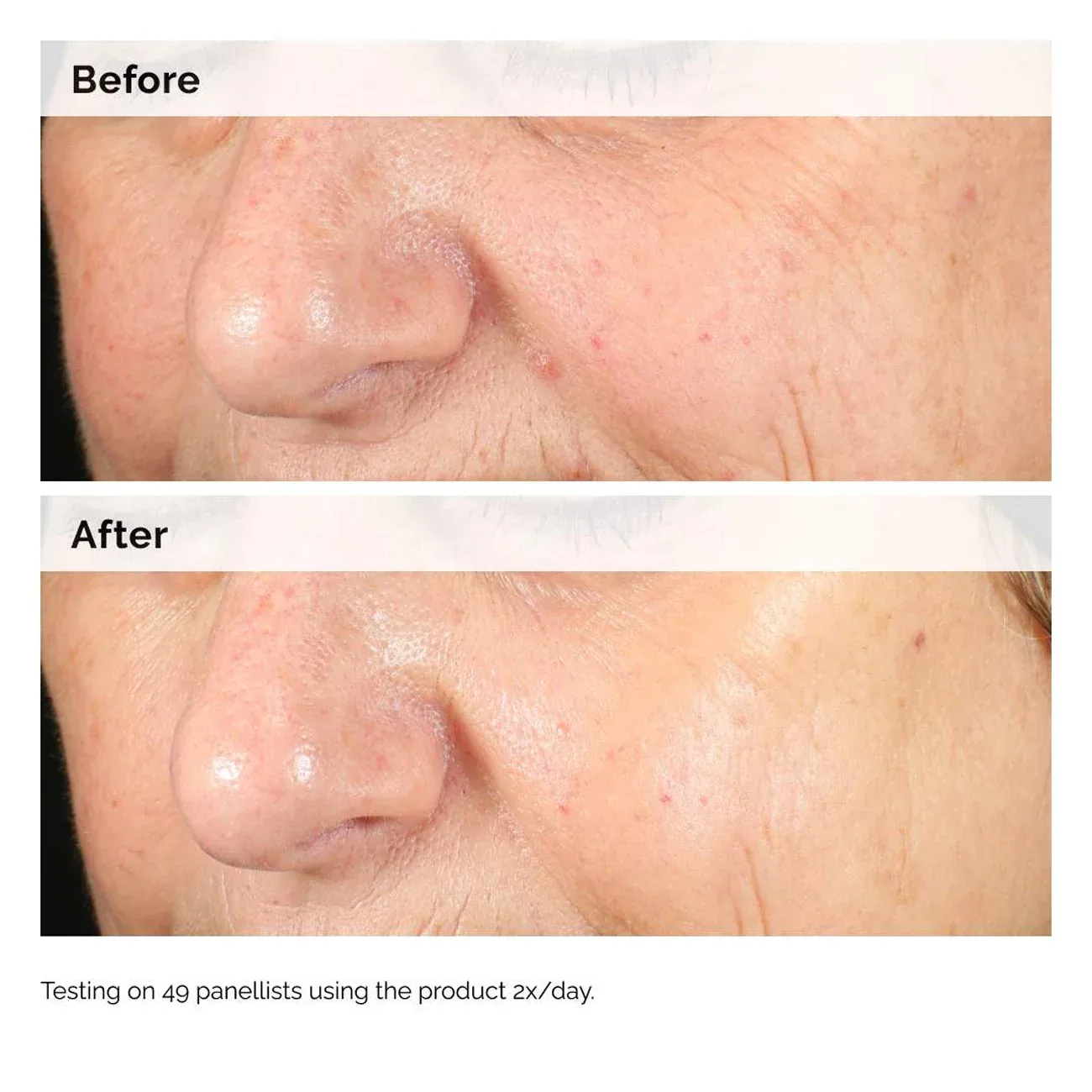 Alpha Arbutin 2% + HA 60ml — image 3